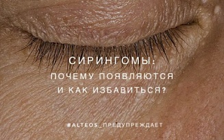 Сирингомы вокруг глаз - почему формируются и как убрать?